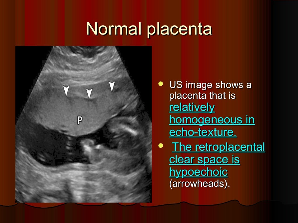 how-to-deal-with-placenta-previa-causes-of-bleeding-in-pregnancy