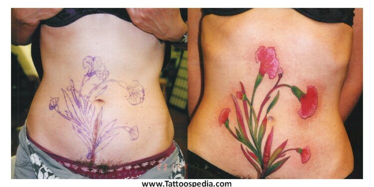 how-long-after-c-section-can-i-get-a-tattoo