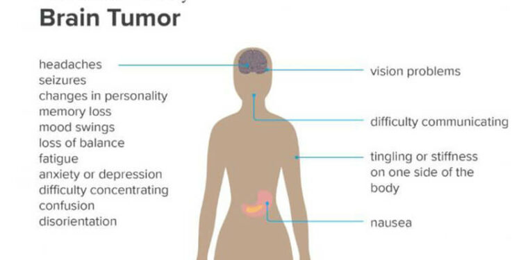 what-can-be-mistaken-for-a-brain-tumor