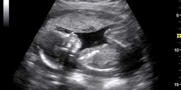 what-does-yellow-on-an-ultrasound-mean