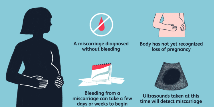 What happens if your body doesn't pass a miscarriage?