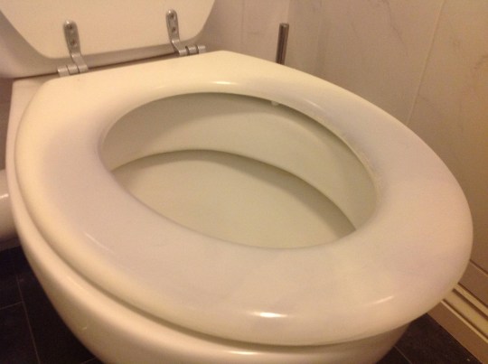 why-has-my-toilet-seat-turned-purple